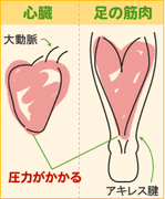 生活不活発病　Disuse syndrome